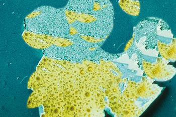 adhesion loss